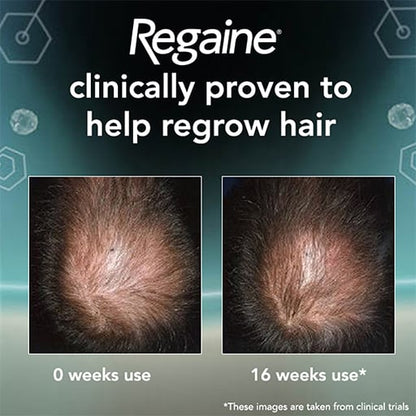 ROGAINE / REGAINE® FOR MEN EXTRA STRENGTH SCALP FOAM