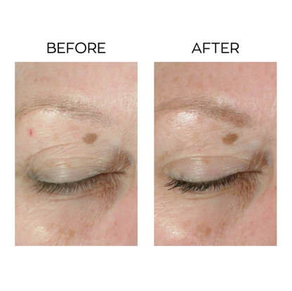 Anew Lifting Protinol Dual Eye System 20ml