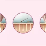 Philips Lumea Prestige IPL Hair Removal Device BRI949