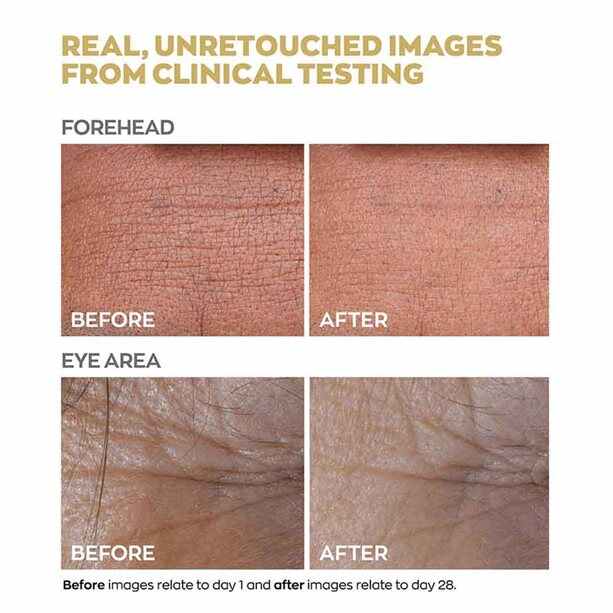 Anew Renewal Protinol Power Serum – 30ml