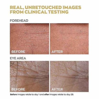 Anew Renewal Protinol Power Serum – 30ml