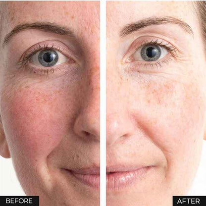 Anew Renewal Protinol Power Serum – 30ml